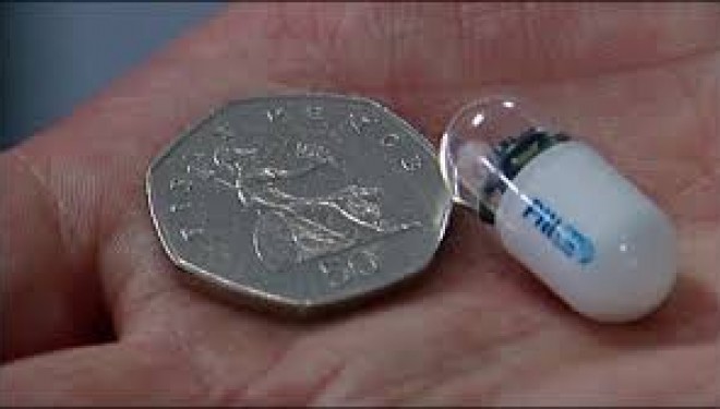 La société israélienne Given Imaging rachetée pour 860 millions de dollars La société israélienne Given Imaging rachetée pour 860 millions de dollars