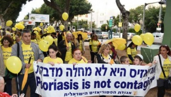 Non, le psoriasis n’est pas contagieux et il se soigne très bien en Israël! Non, le psoriasis n’est pas contagieux et il se soigne très bien en Israël!