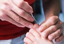 santé : Non aux ongles incarnes !