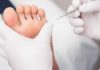 Cors, durillons, verrues plantaires, quelles différences ?
