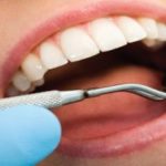 bouche-materiel-dentiste-prix-dentiste