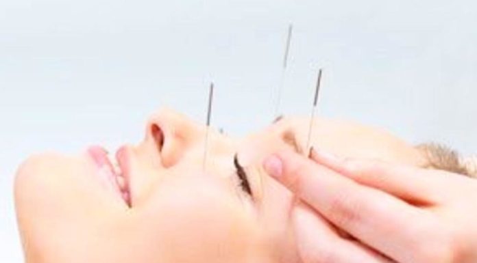 L’Acupuncture Médicale efficace pour traiter la Fibromyalgie par le Dr Joseph Zrihen