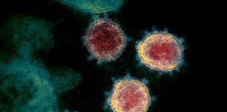 Des chercheurs israéliens disent que le cannabis médical pourrait traiter efficacement certains symptômes du COVID-19