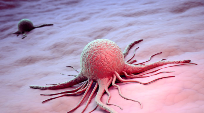 REGARDER : Les Israéliens inventent le tout premier test de dépistage du cancer en 2 heures