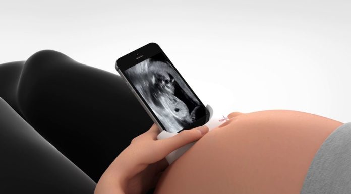 Une start-up israélienne lance la toute première échographie à domicile pour les futures mamans