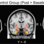 Le confinement provoque un changement dans les zones du cerveau régulant le stress et l’anxiété, d’après une étude de l’Université de Tel-Aviv