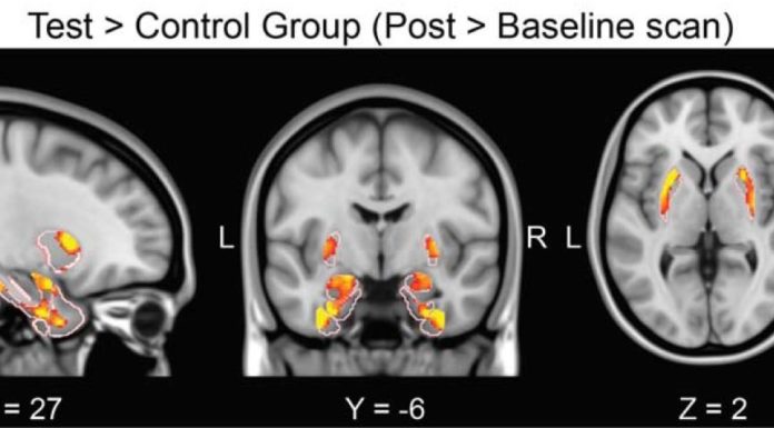 Le confinement provoque un changement dans les zones du cerveau régulant le stress et l’anxiété, d’après une étude de l’Université de Tel-Aviv