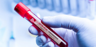 Les tests sérologiques COVID-19 pour les personnes vaccinées à l’étranger sont disponibles à l’aéroport Ben Gourion