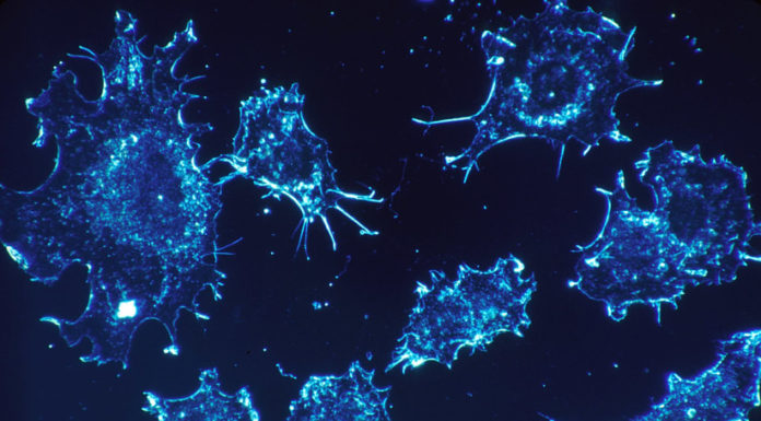 Mois de la sensibilisation au cancer du sang en Israël : explorer des traitements innovants