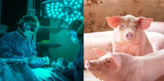 Les greffes d’organes de porc sur les humains sont-elles autorisées dans le judaïsme ?