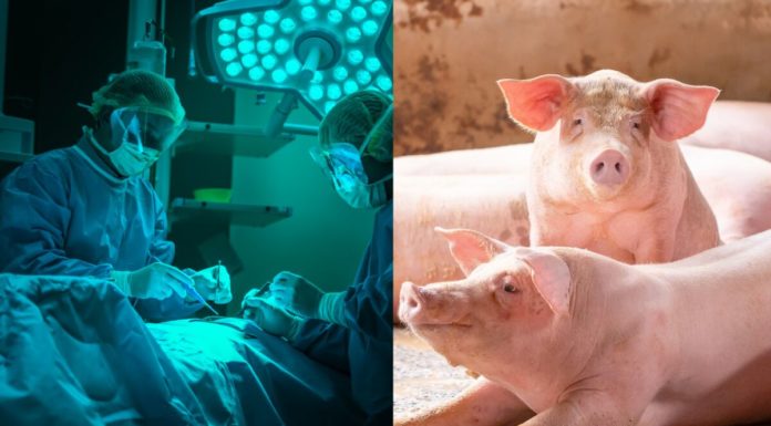 Les greffes d’organes de porc sur les humains sont-elles autorisées dans le judaïsme ?