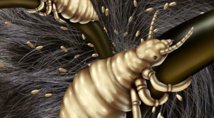 Les poux de tête, un fléau en Israël !