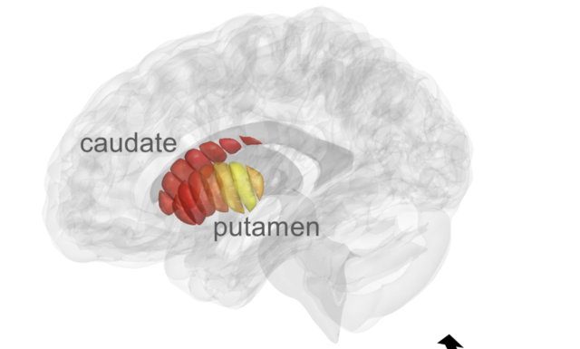 Israël : un scanner cérébral pour effectuer le dépistage précoce de la maladie de Parkinson bientôt