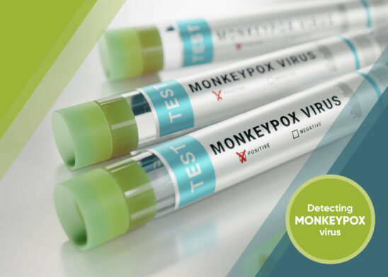 Germany R-Biopharm MonkeyPox Virus Detection Test