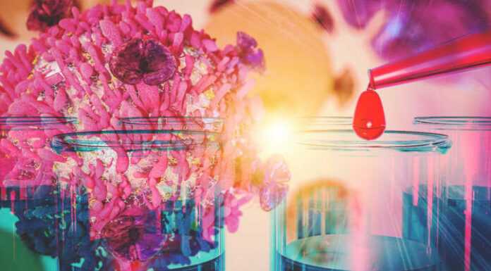 Percée israélienne : la propagation du cancer du sein stoppée grâce à un nouveau traitement