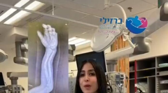 Santé : Flotter dans les airs, atterrir dans un hôpital : la nouvelle tendance contre laquelle Barzilai met en garde