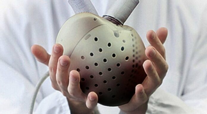 Percée médicale en Israël : un cœur artificiel implanté à Hadassah Ein Kerem selon une technique française